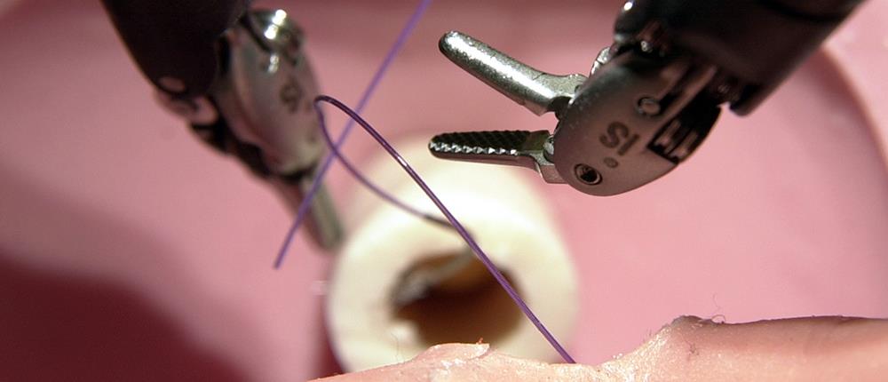 Ρομποτική Χειρουργική στη γυναικολογία