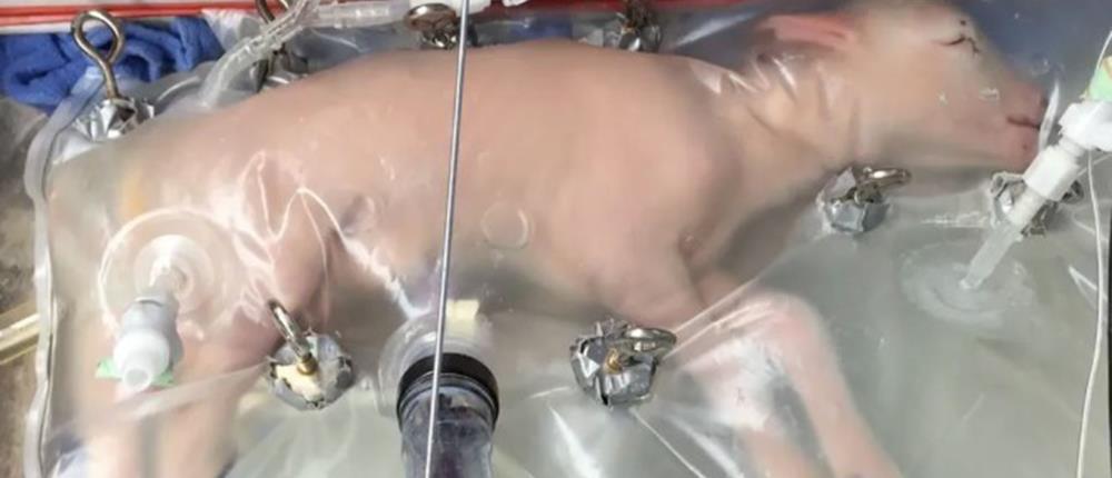 Δημιούργησαν τεχνητή μήτρα (βίντεο)