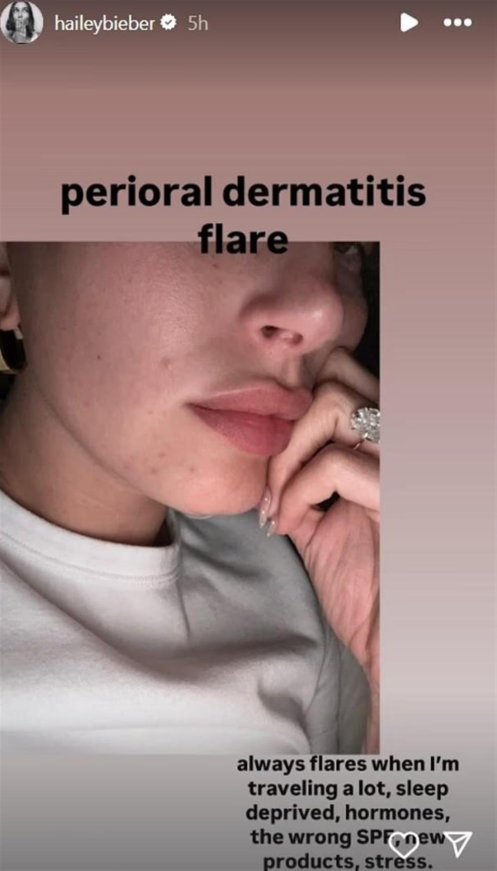 Χέιλι Μπίμπερ