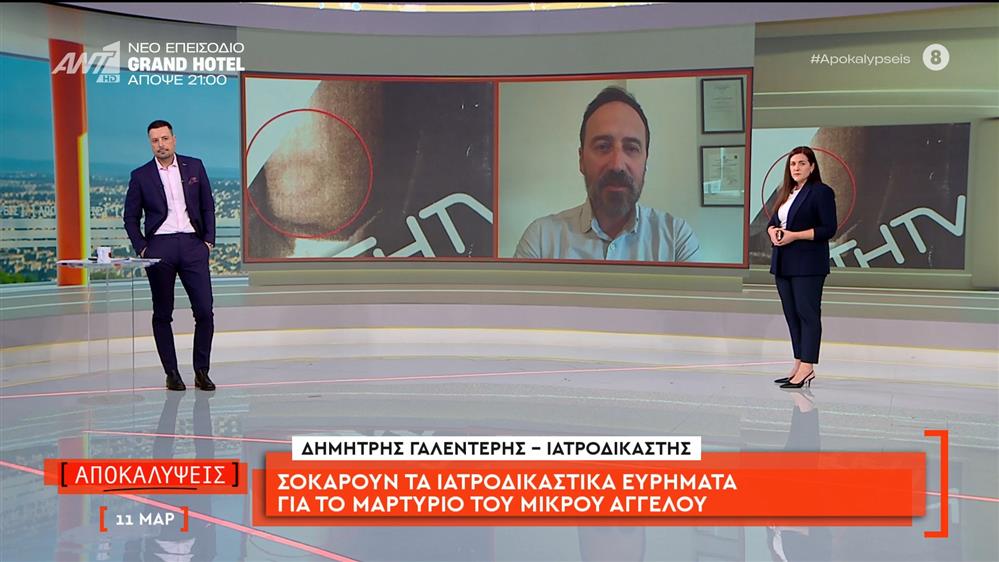 Σοκάρουν τα ιατροδικαστικά ευρήματα για το μαρτύριο του μικρού Άγγελου