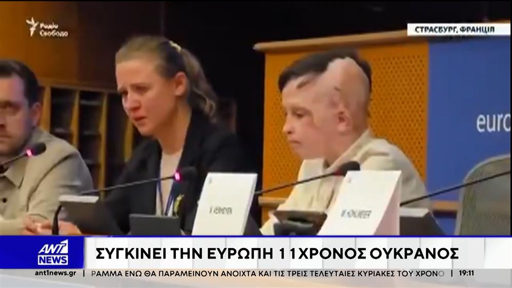 Συγκινεί την Ευρώπη ο 11χρονος Ουκρανός: Είδε την μητέρα του να σκοτώνεται σε ρωσικό βομβαρδισμό, τραυματίστηκε βαριά και χρειάστηκε να υποβληθεί σε 35 χειρουργικές επεμβάσεις.