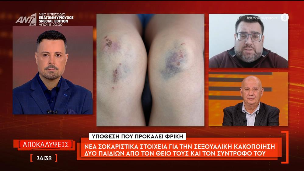 Νέα σοκαριστικά στοιχεία για την σεξουαλική κακοποίηση δύο παιδιών από τον θείο τους και το σύντροφο του