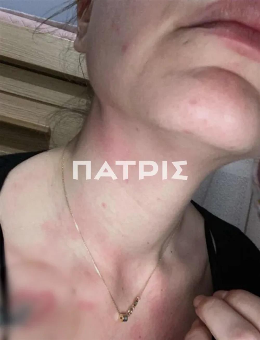 ΚΡΗΤΗ - ΕΝΔΟΟΙΚΟΓΕΝΕΙΑΚΗ ΒΙΑ