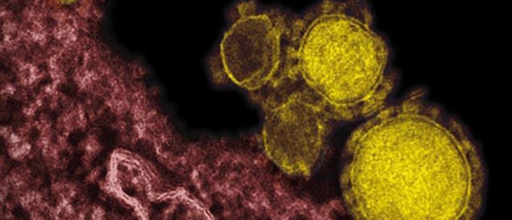 Mers- Ιός - Μικρόβιο