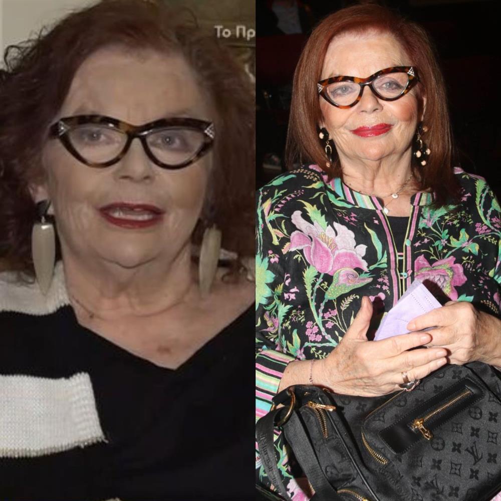 Η Νόρα Κατσέλη για το εγκεφαλικό που πέρασε: "Πήγα στο νοσοκομείο και έμεινα 4 μήνες. Έκανα εγχείρηση στον εγκέφαλο"