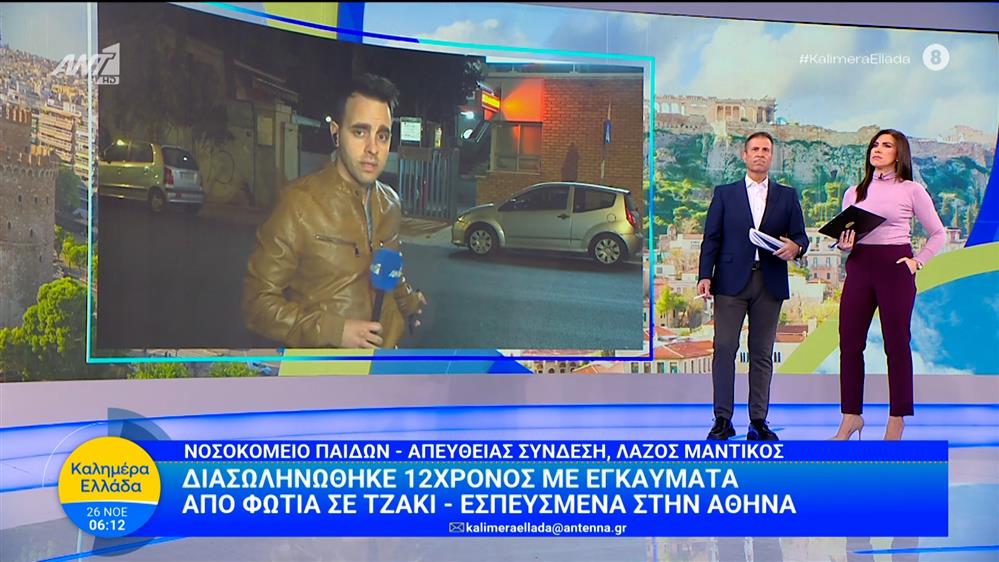 Διασωληνώθηκε 12χρονος με εγκαύματα από φωτιά σε τζάκι – Καλημέρα Ελλάδα – 26/11/2025