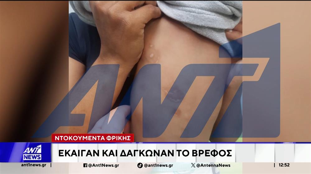 Κακοποίηση βρέφους στον Πύργο: Προφυλακίζονται η μητέρα και ο σύντροφός της