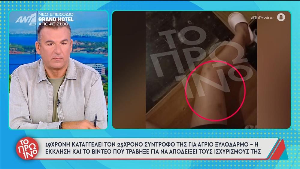 19χρονη καταγγέλει τον 25χρονο σύντροφό της για άγριο ξυλοδαρμό - Το Πρωινό - 10/11/2025