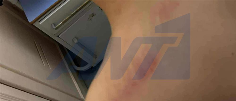 Θεσσαλονίκη - 13χρονος - ξυλοδαρμος