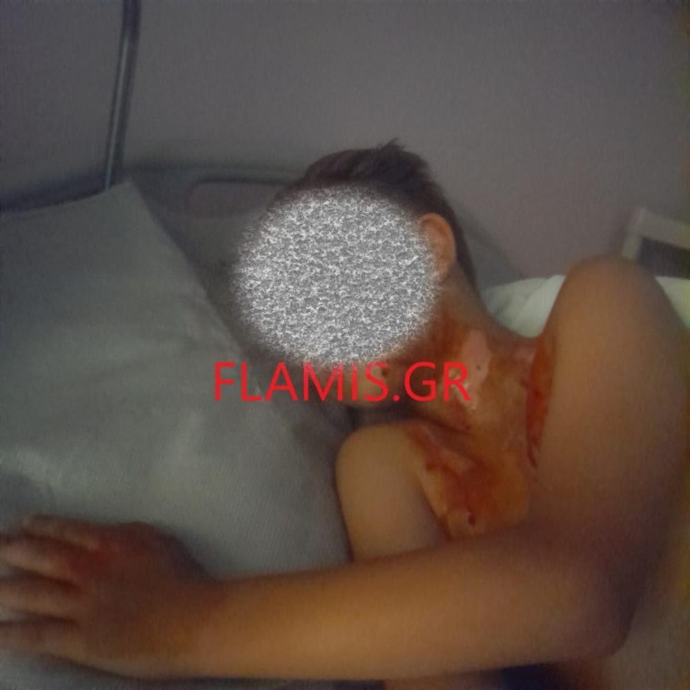 Πάτρα - Βεγγαλικά - Σχολείο - Τραυματίας μαθητής Πάτρα - Βεγγαλικά - Σχολείο - Τραυματίας μαθητής