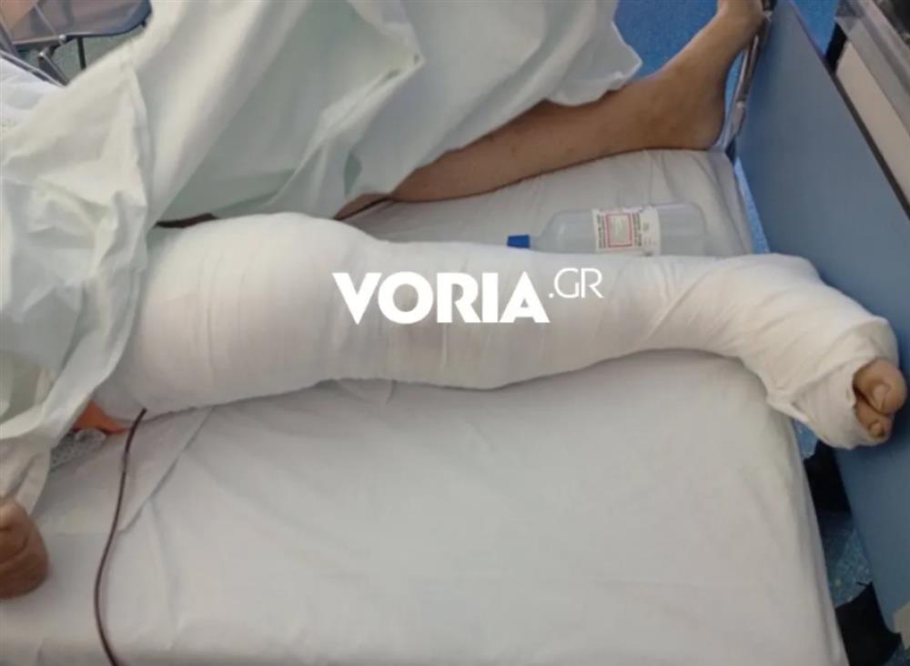 Επίθεση - ΑΜΕΑ - Αδέσποτοι - Σκύλοι