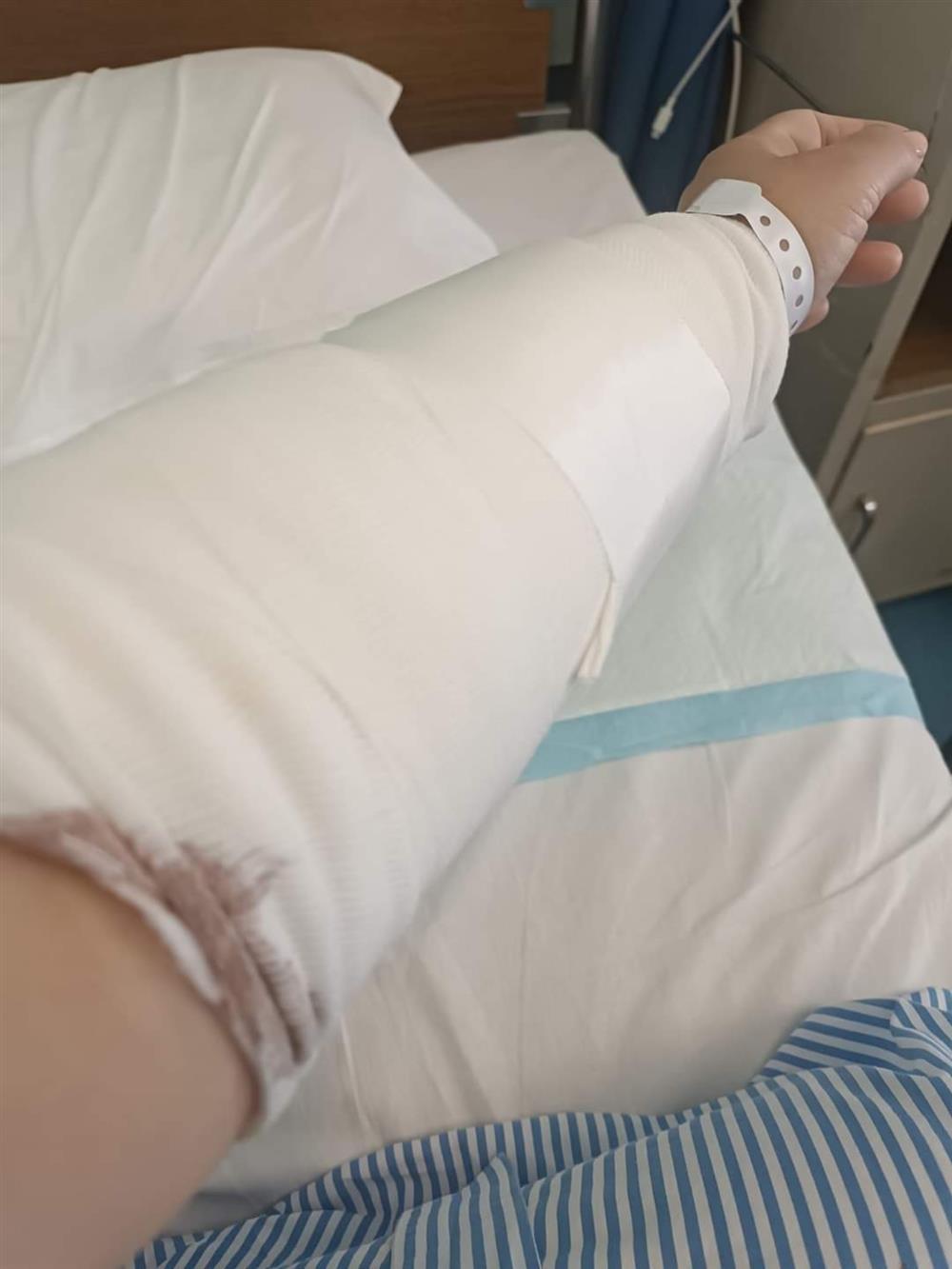 Χαλκιδική - δάγκωμα Χαλκιδική - δάγκωμα