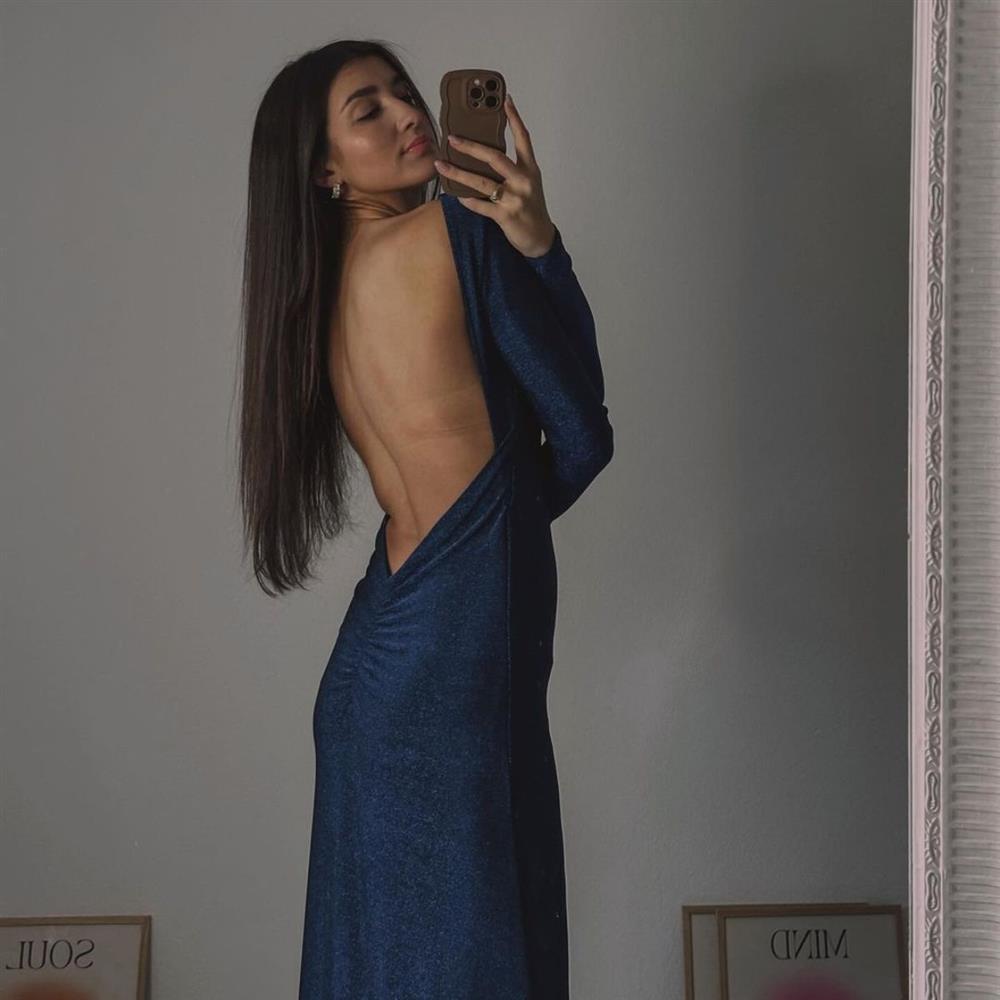 Κατερίνα Βισέρη: Η εξομολόγηση για τη νευρική ανορεξία - "Καμία λιποθυμία, κανένας πόνος και καμία νοσηλεία δεν με τρόμαζαν"