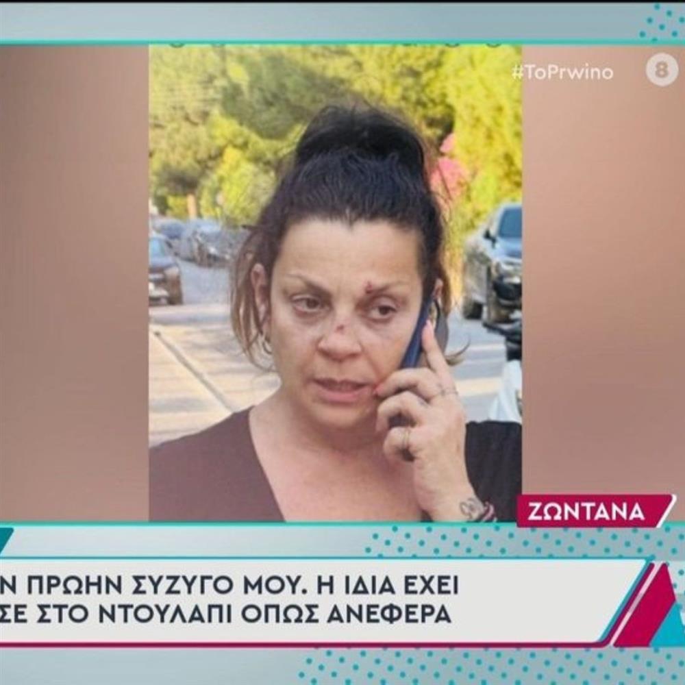 Στάθης Αγγελόπουλος πρώην σύζυγός