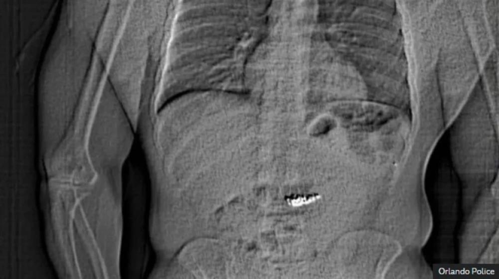 ΟΡΛΑΝΤΟ - ΛΗΣΤΕΙΑ - ΚΟΣΜΗΜΑΤΑ