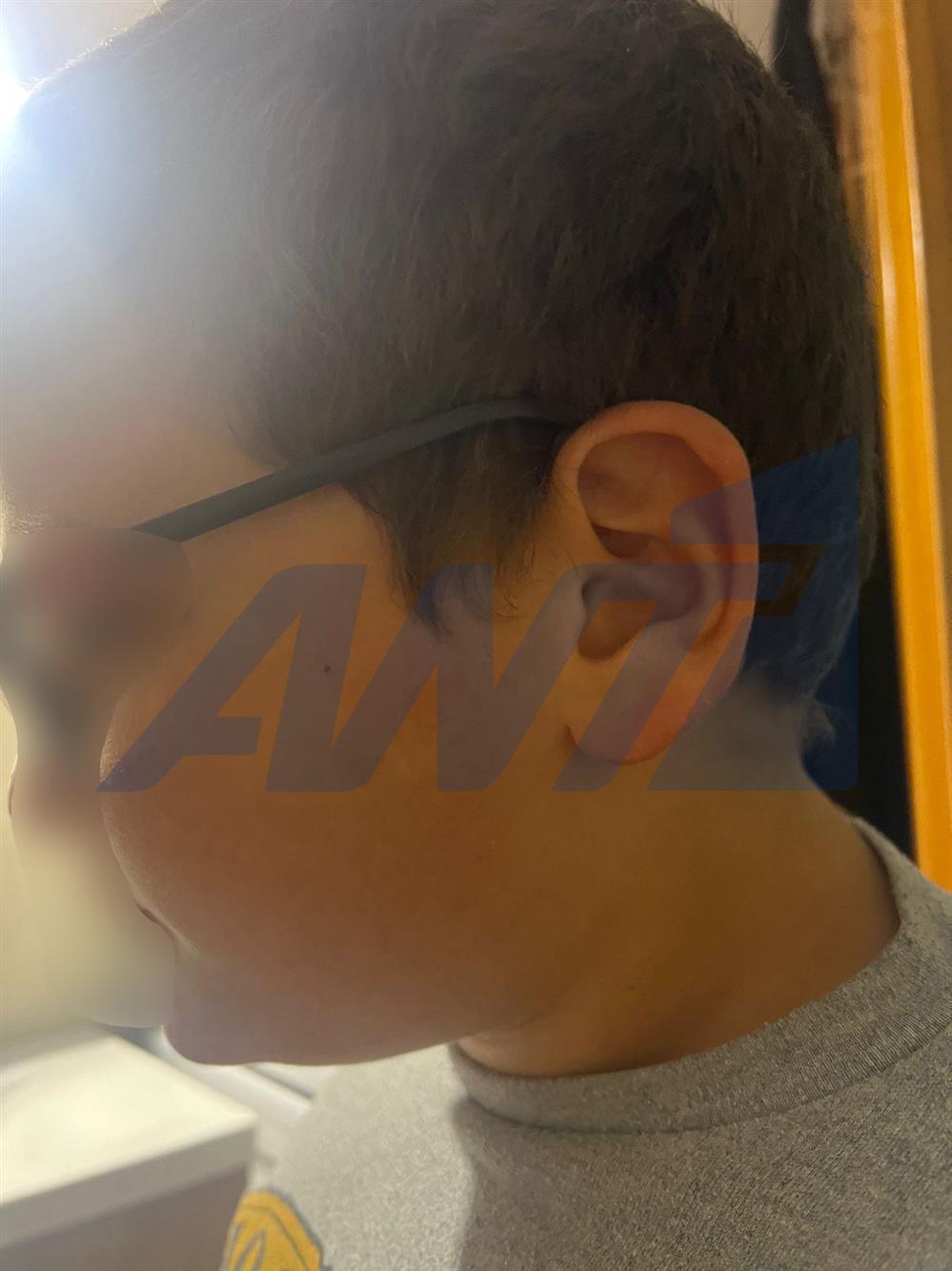 Θεσσαλονικη - ξυλοδαρμος - 11χρονος