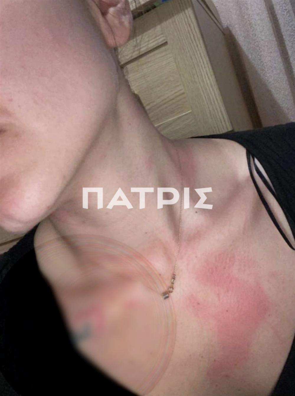 ΚΡΗΤΗ - ΕΝΔΟΟΙΚΟΓΕΝΕΙΑΚΗ ΒΙΑ