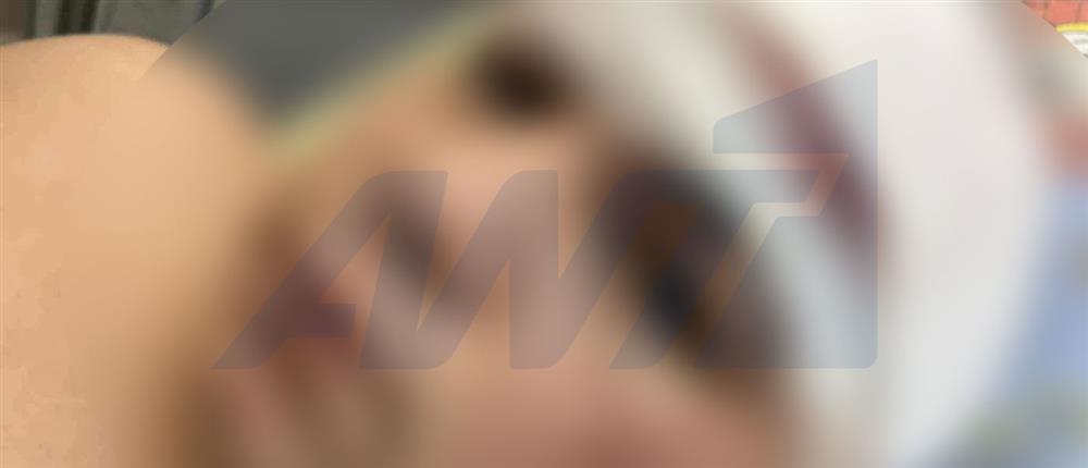 Θεσσαλονίκη - 13χρονος - ξυλοδαρμος