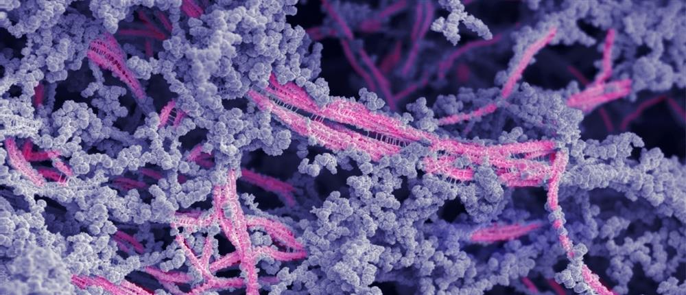 Βιοενεργό υλικό αναγεννά τους χόνδρους των γονάτων