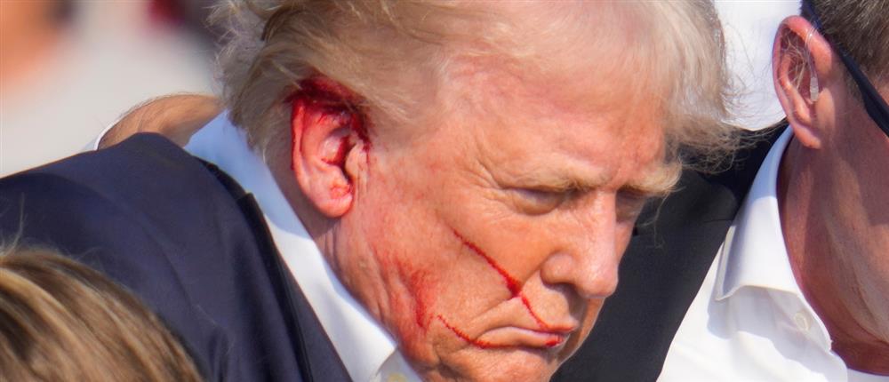 Ντόναλντ Τραμπ - πυρολοβολισμός