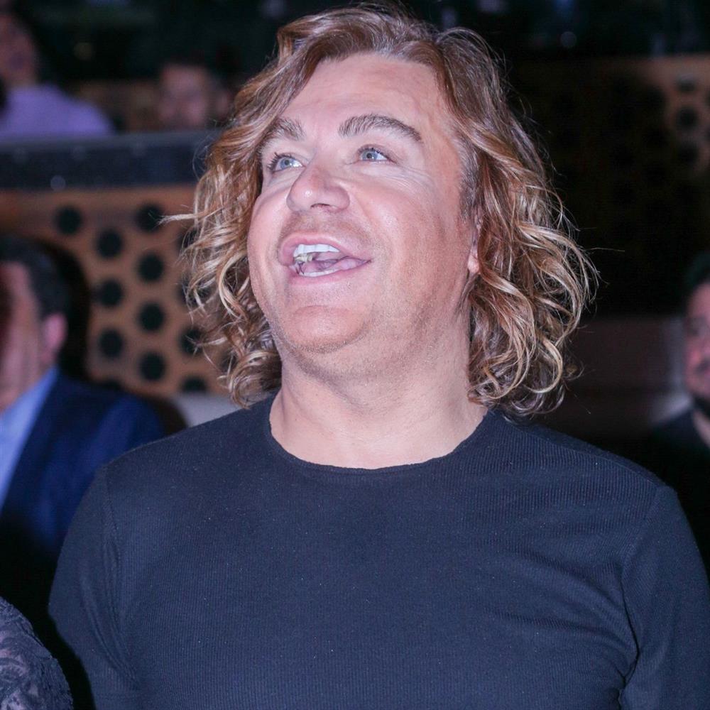 Τρύφωνας Σαμαράς: Η απάντηση για τις αισθητικές επεμβάσεις - "Είχα παραμορφωθεί στα χείλη και δεν μου άρεσε"