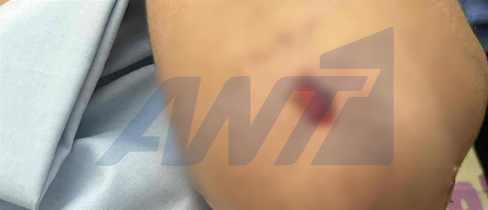 Θεσσαλονίκη - 13χρονος - ξυλοδαρμος