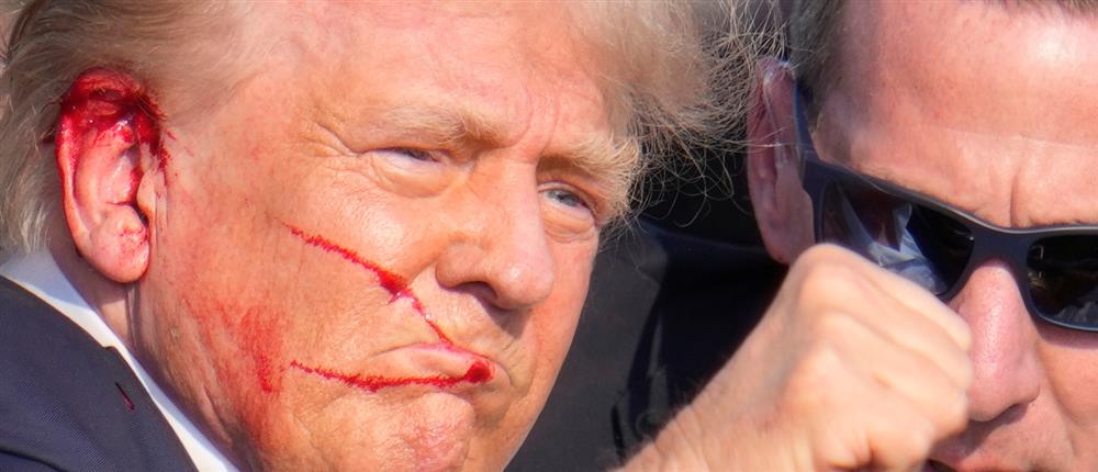 Ντόναλντ Τραμπ - πυρολοβολισμός