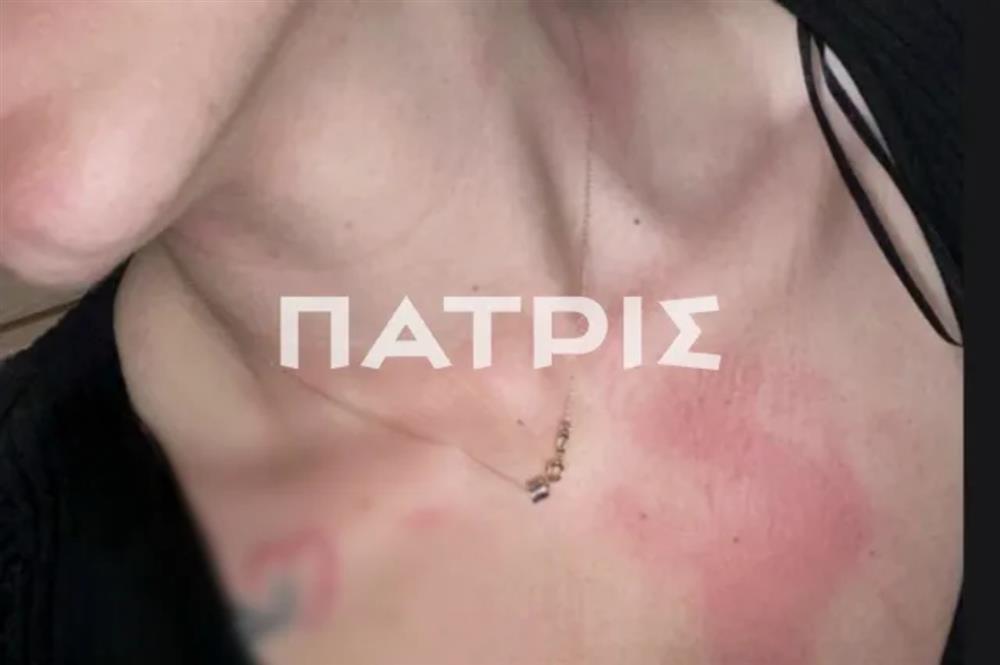 ΚΡΗΤΗ - ΕΝΔΟΟΙΚΟΓΕΝΕΙΑΚΗ ΒΙΑ