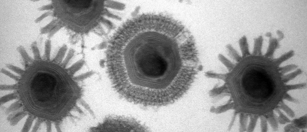γιγάντιοι ιοί - μονοκύτταροι οργανισμοί - Klosneuviruses