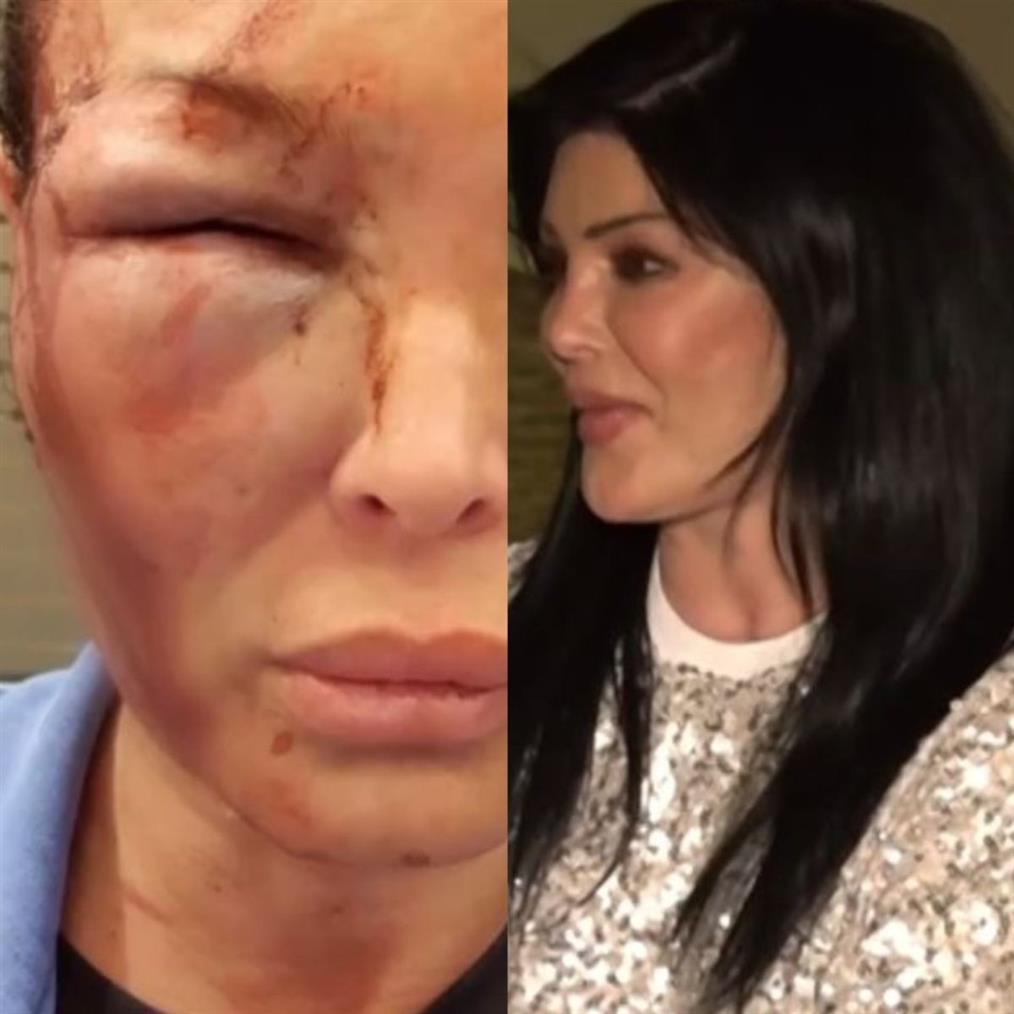 Μαντώ Τζαβάρα: Τα πρώτα λόγια μετά τη δικαστική απόφαση για τον πρώην σύντροφό της - "Επικαλέστηκε κάτι τρελά σενάρια"
