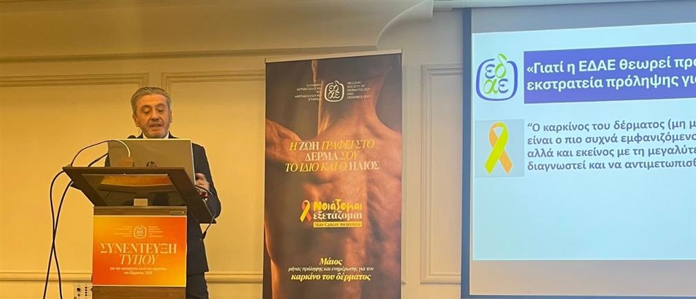 «ΝΟΙΑΖΟΜΑΙ. ΕΞΕΤΑΖΟΜΑΙ» - Και ο Μάιος γίνεται μήνας δράσης ενάντια στον Καρκίνο του Δέρματος