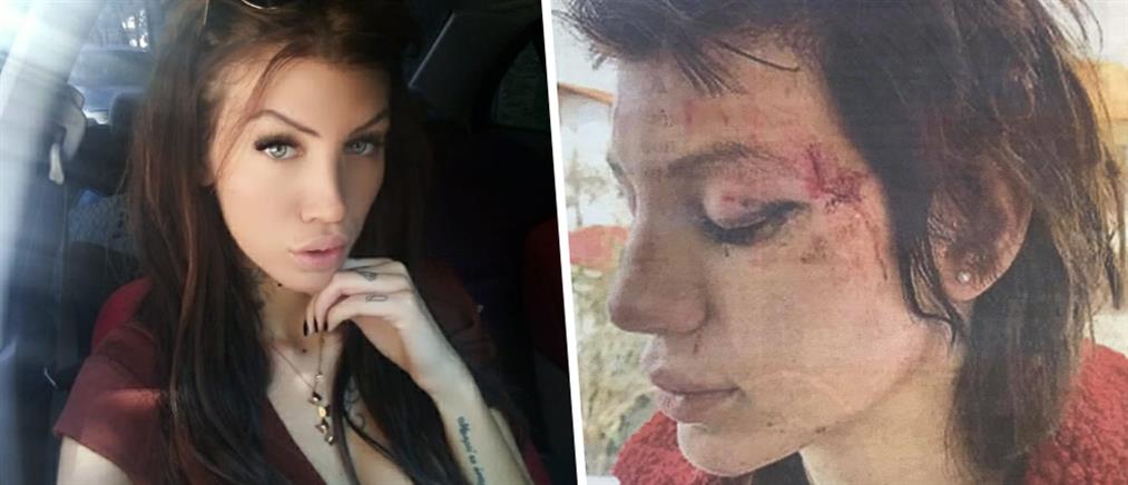 Μαρία Αλεξάνδρου: καταγγελία για απαγωγή και ξυλοδαρμό από έξι γυναίκες (εικόνες)