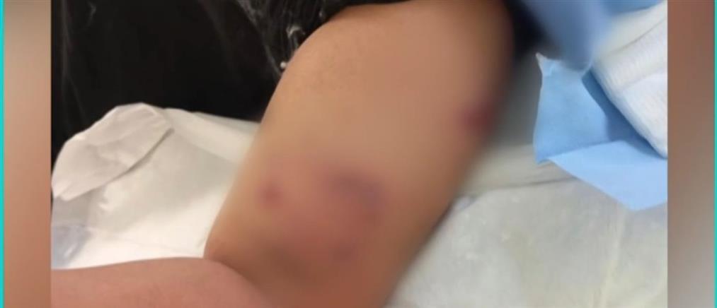 Σοκ στο Πέραμα: Σκύλος επιτέθηκε και τραυμάτισε 12χρονο έξω από σχολείο