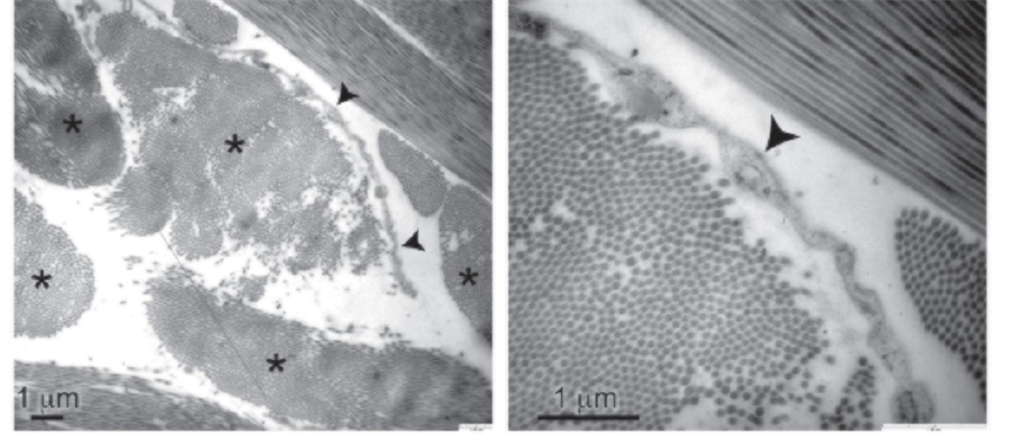 Ανακαλύφθηκε ένα νέο όργανο στο ανθρώπινο σώμα!