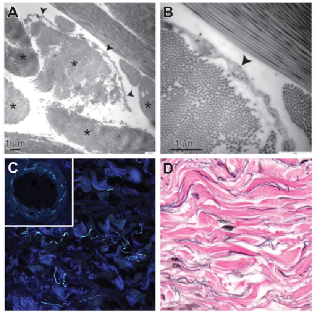 Νέο ανθρώπινο όργανο