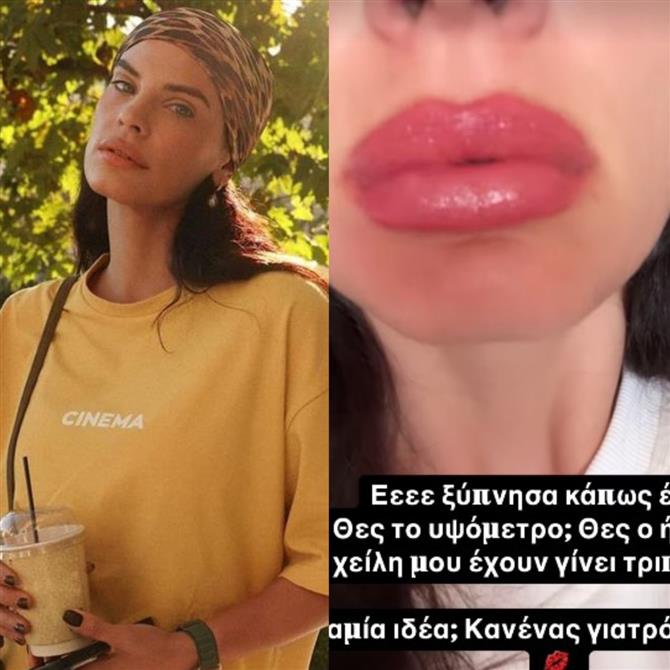 Χριστίνα Μπόμπα: "Ξύπνησα έτσι, τα χείλη μου έγιναν τριπλάσια"(Φωτογραφία)